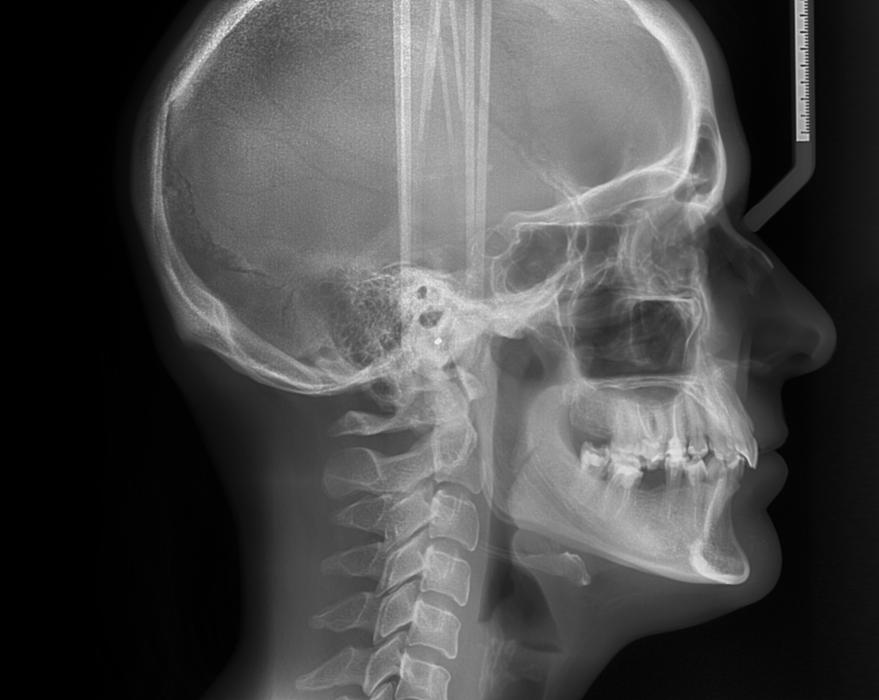close up of dental x-ray | southampton dentist