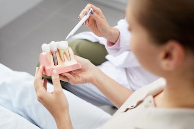dental implants in southampton ny