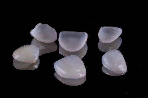 close up of porcelain veneers | veneers southampton