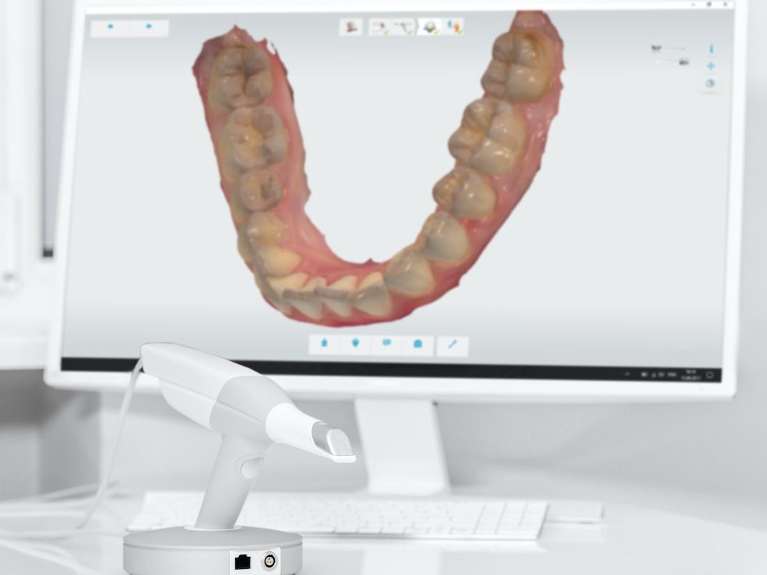 3D digital impression of lower jaw | dentist near southampton