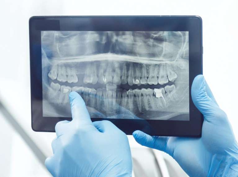 image of dental x-ray | dentist in the hamptons